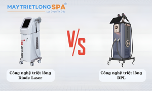 so sanh cong nghe triet long diode laser va dpl 1