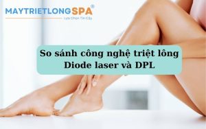 so sánh công nghệ triệt lông diode laser và dpl