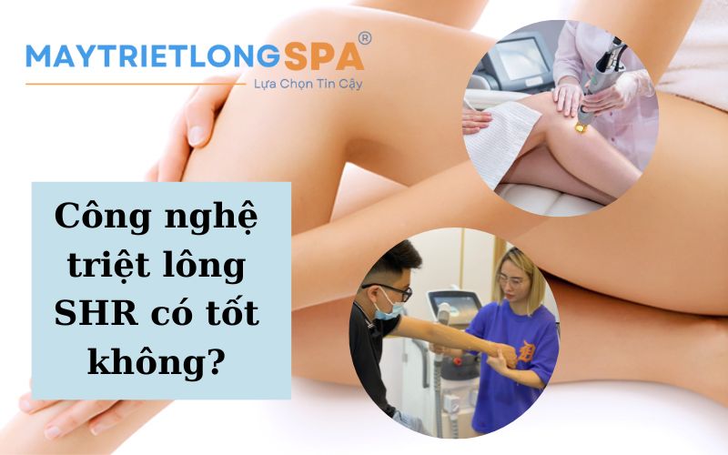 Công nghệ triệt lông SHR