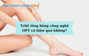 Triệt lông bằng công nghệ OPT