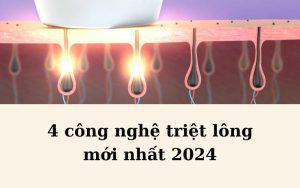 Công nghệ triệt lông mới nhất